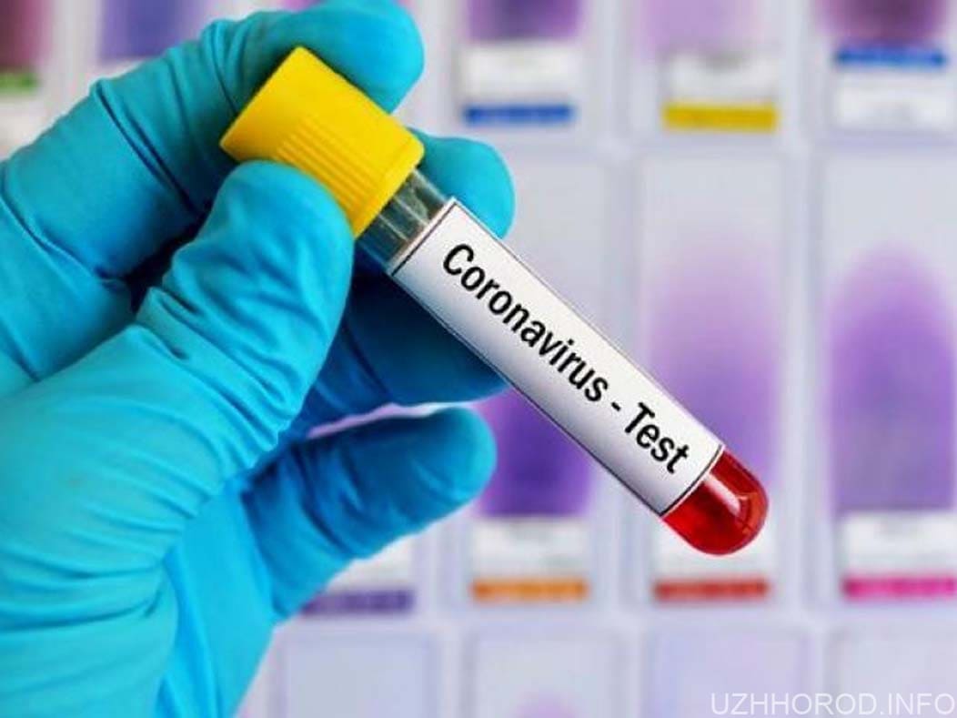 За минулу добу виявлено 23 нові випадки коронавірусної інфекції, 1 людина померла. 31.10.21