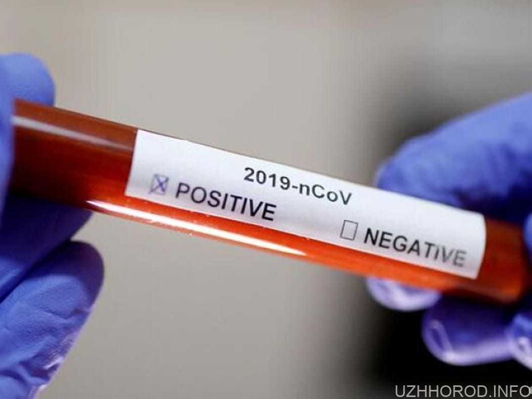 Закарпаття отримало понад 5 тисяч тестів на коронавірус фото