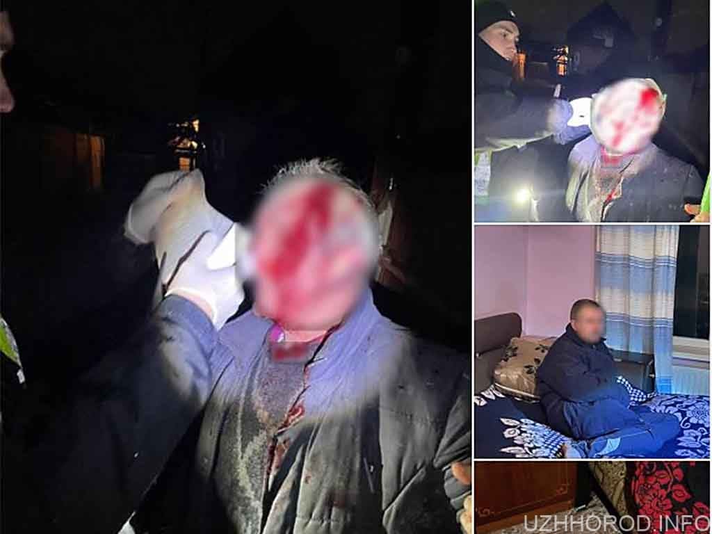 Психічнохворий син побив власного батька в Ужгороді