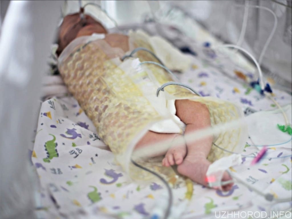 В Мукачівській лікарні св. Мартина проводять штучне охолодження немовлят, заради їхнього порятунку