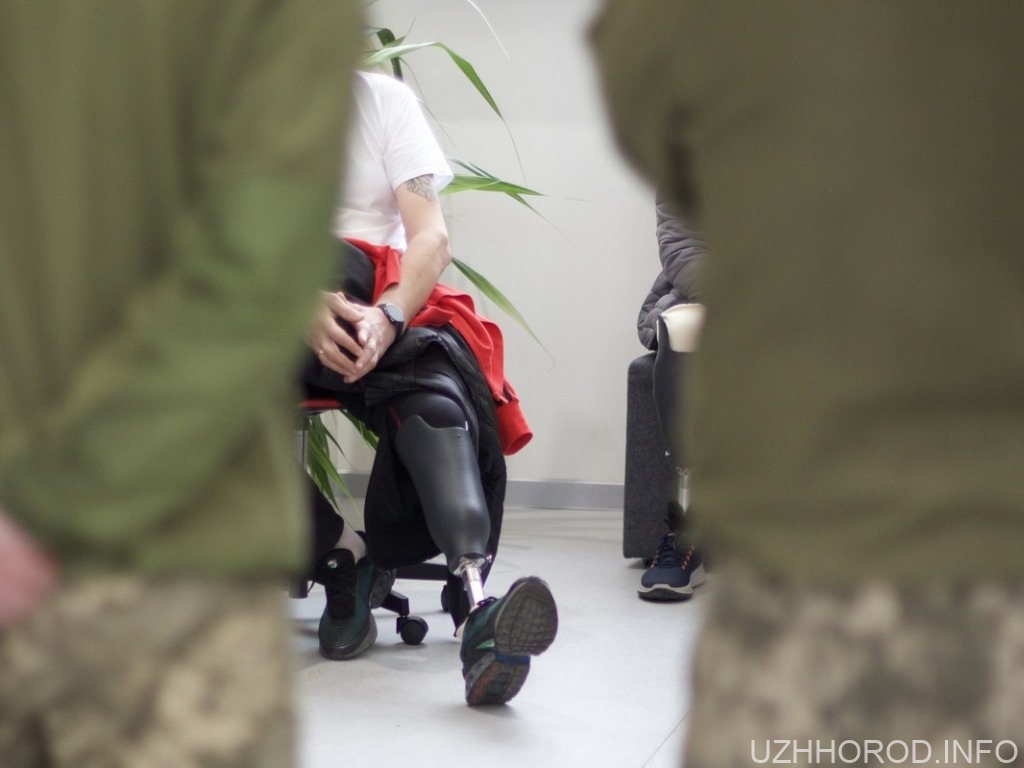 На Закарпатті продовжують створювати протези для пацієнтів на 3D-принтері