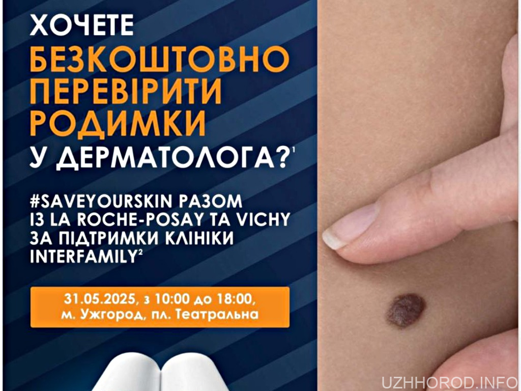 Безкоштовно перевірити родимки у фахівців