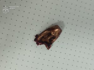 На Закарпатті розслідують загибель чоловіка від пострілу лісника